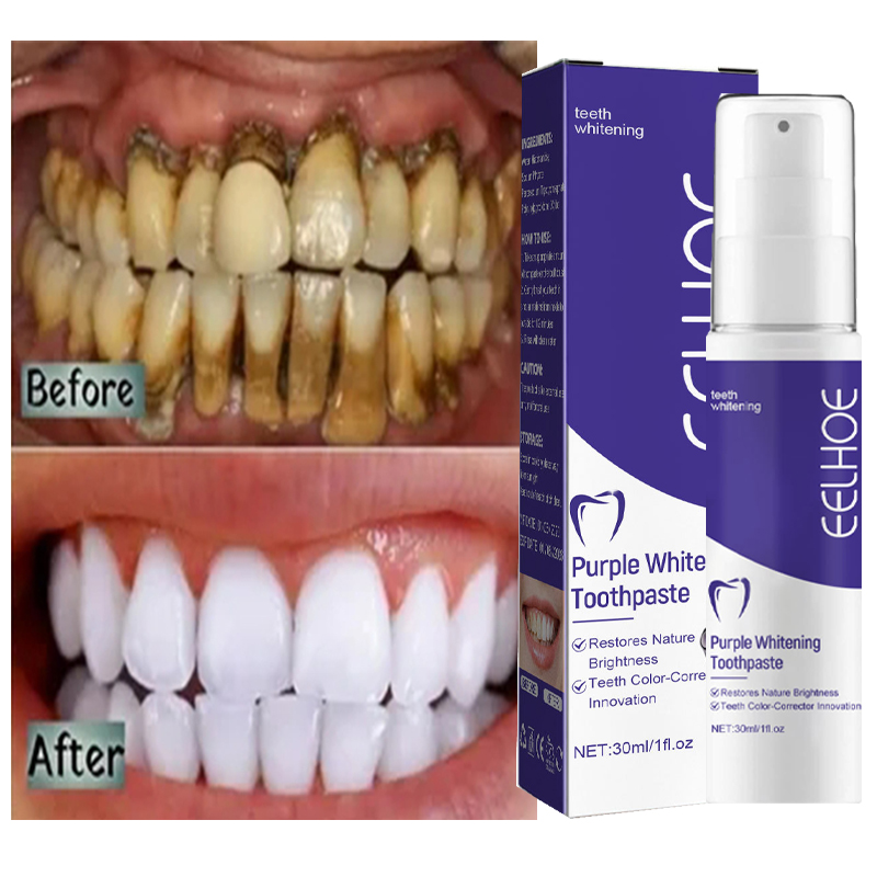 Teeth Whitening In Korea - 1pcs Teeth Cleansing Whitening Toothpaste Whiten