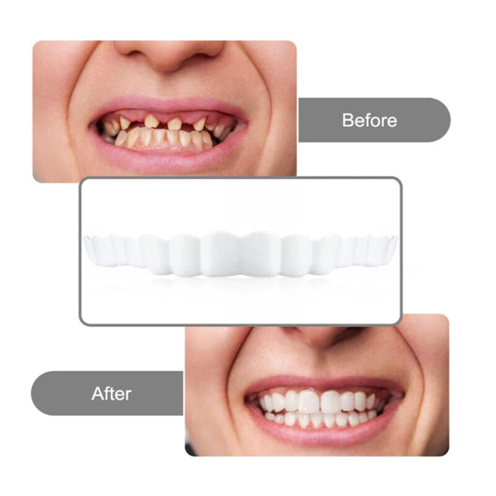 licone Denture Set Fit Tempora - Teeth Whitening Usa recension och pris