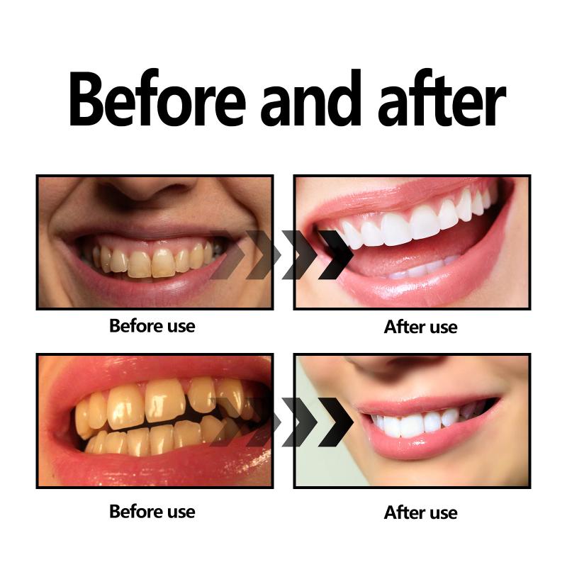 Teeth Whitening Powder Charcoa - Teeth Whitening Charcoal Powder recension och pris