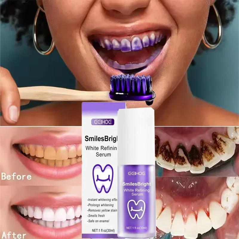Teeth Cleansing Whitening Toot - Teeth Whitening In Korea recension och pris