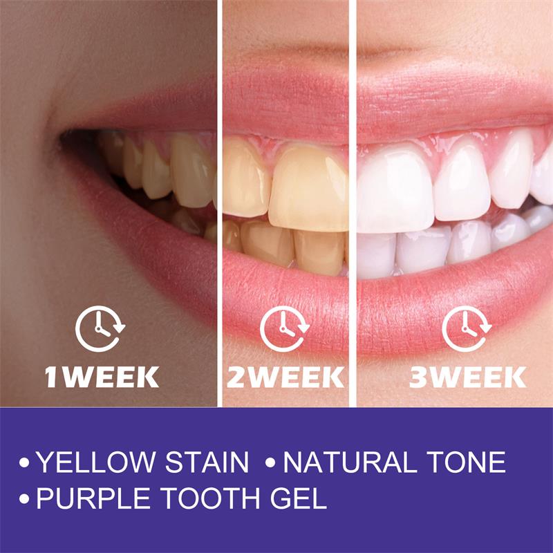 1pcs Teeth Cleansing Whitening - Teeth Whitening In Korea recension och pris