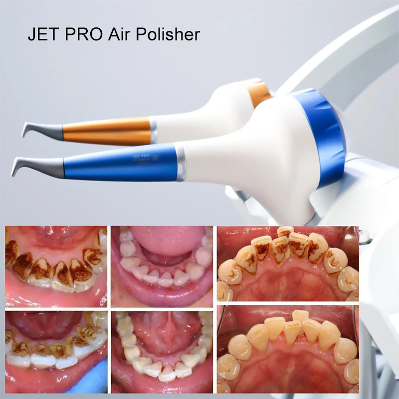 VV Dental  Air Polishing Proph - Teeth Whitening Dental recension och pris