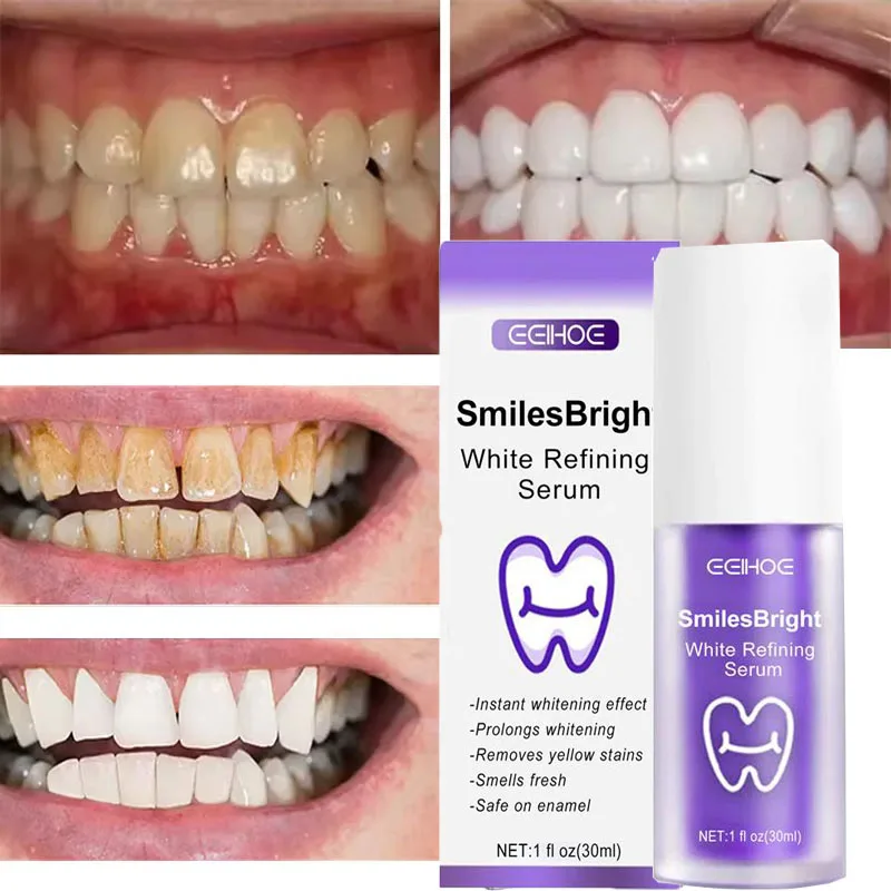Whitening Toothpaste Teeth Cle - Teeth Whitening In Korea recension och pris